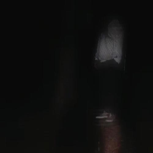 sleep apnea (Explicit)