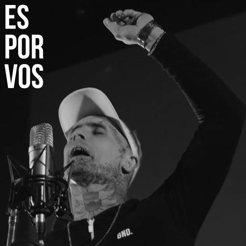 Es Por Vos