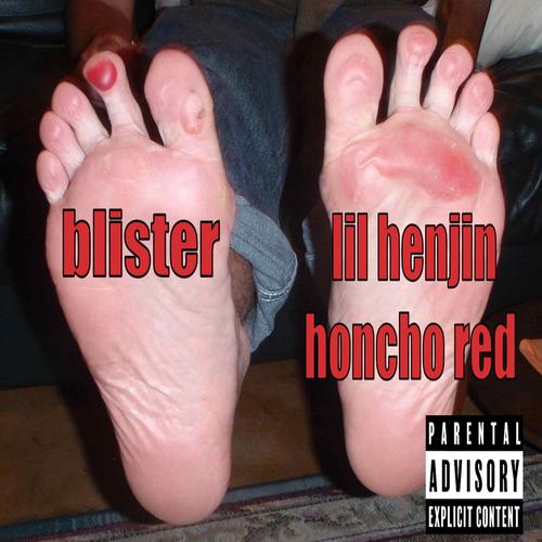 blister (feat. Honcho Red) [Explicit]