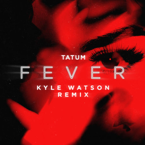 Fever (Kyle Watson Remix)