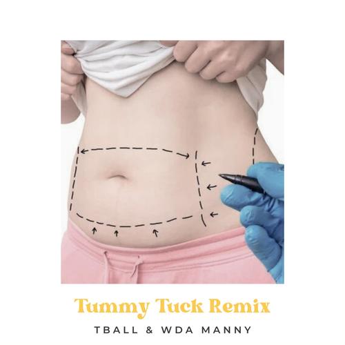 Tummy Tuck (feat. WDA Manny) [REMIX] [Explicit]