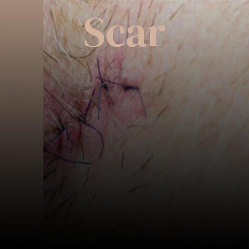 Scar