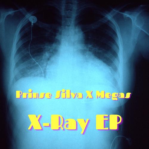 X-Ray EP