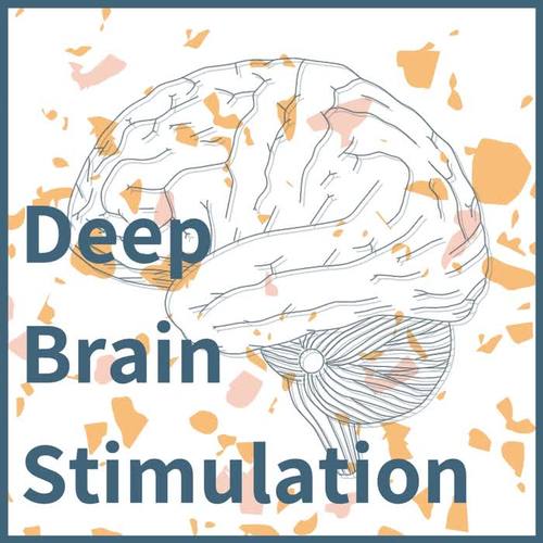 Deep Brain Stimulation: Relaxing Delta Waves to Induce a Very Deep Sleep