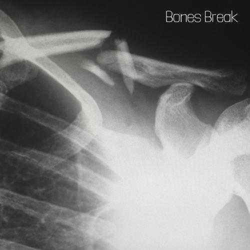 Bones Break