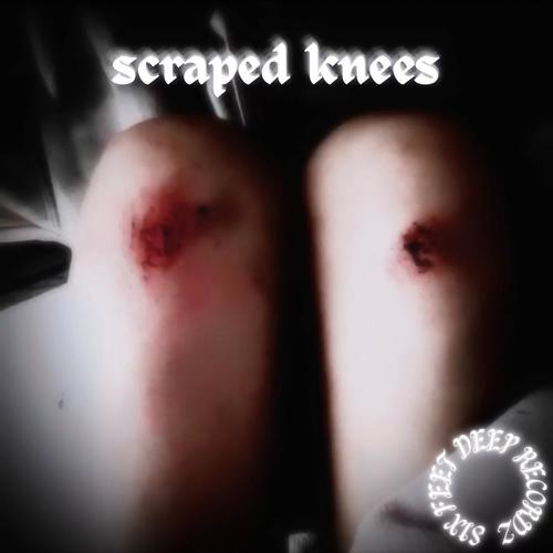 Scraped Knees (Explicit)