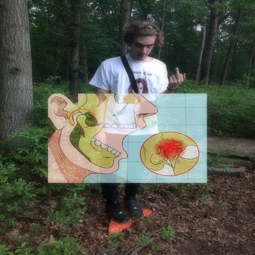 lock jaw (Explicit)