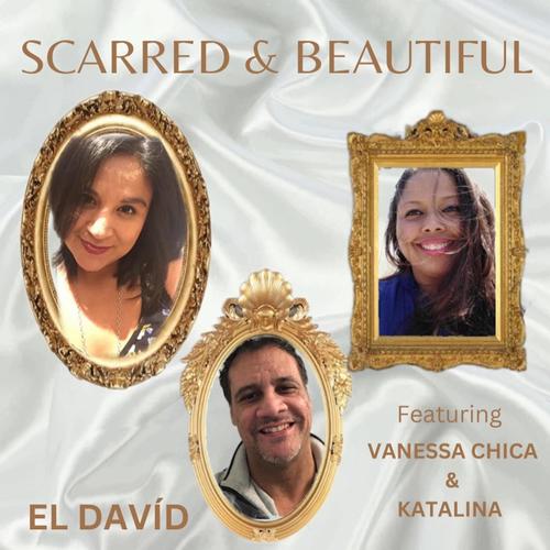 SCARRED & BEAUTIFUL (feat. VANESSA CHICA & KATALINA) [Explicit]