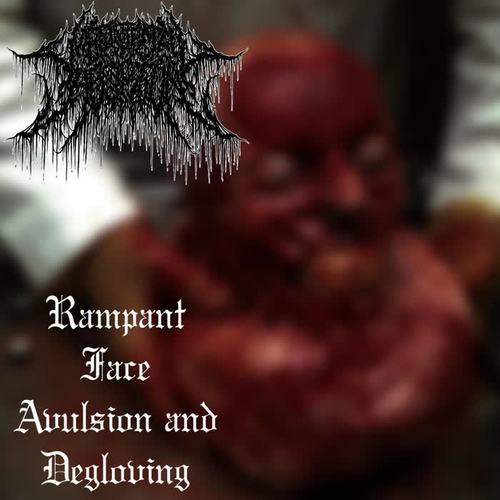 Rampant Face Avulsion and Degloving (Explicit)