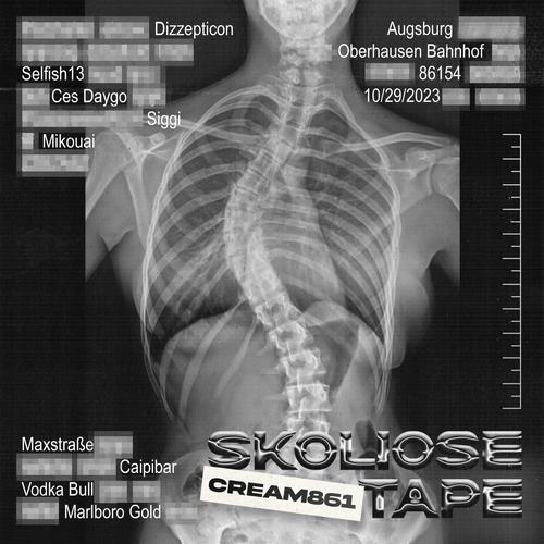 Skoliose Tape (Explicit)