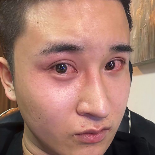 还我妈生鼻 - 秦鑫吖