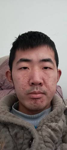 搀扶,