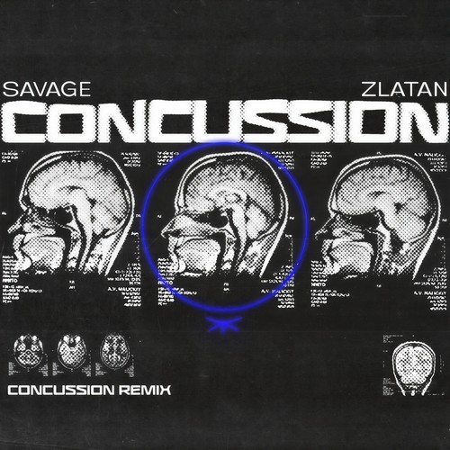 Concussion (Remix) [Explicit]